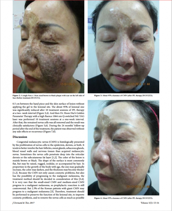 38094386fb9016cf4f50c8ed2d6a6de7_1492591