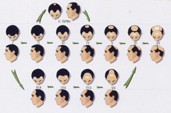 2a7e53c102df9d8cba7ddd6efc9bcb22_1499128