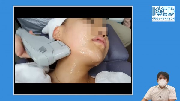 caceaa6b3ea3aa71bd07137368f9f83b_1642900